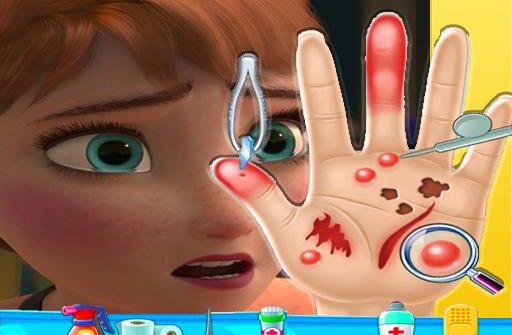 anna frozen hand doctor fun games for girls onlin