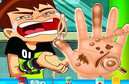 ben10 hand doctor free online game